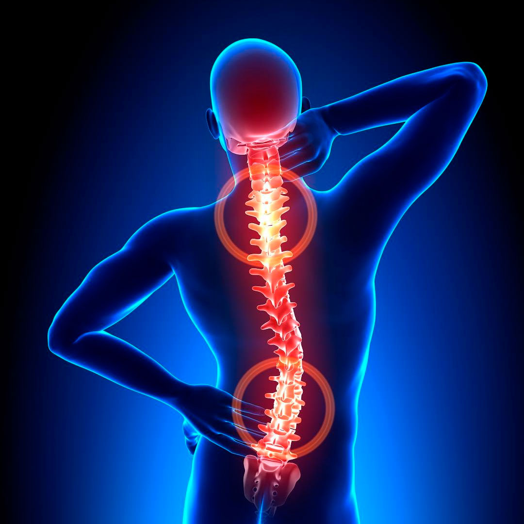 Osteopatia: Prevenir dolor de espalda